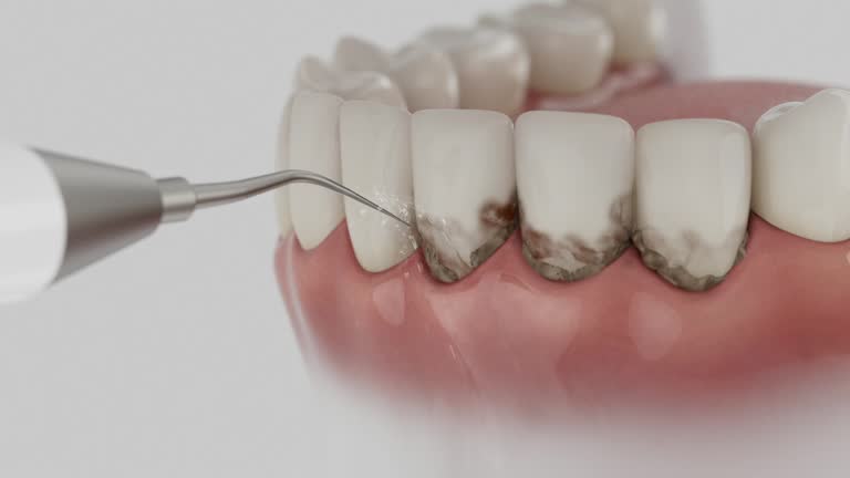 Trusted Tooth Extraction service in Marbleton, WY - Dentist Open Now